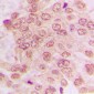 Anti-CDK2 Antibody